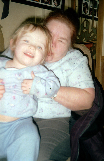 mgph11